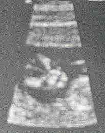 ultrasound1.jpg